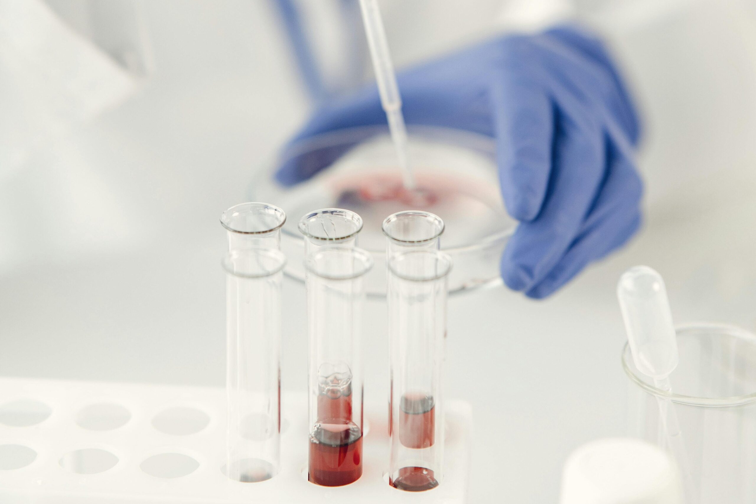 antioxidant-use-for-male-fertility-sperm-health